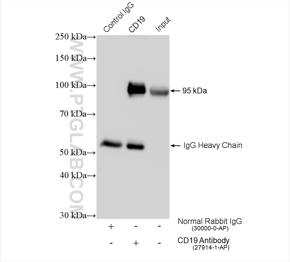 Immunoprecipitation (IP) experiment of Raji cells using CD19 Polyclonal antibody (27914-1-AP)