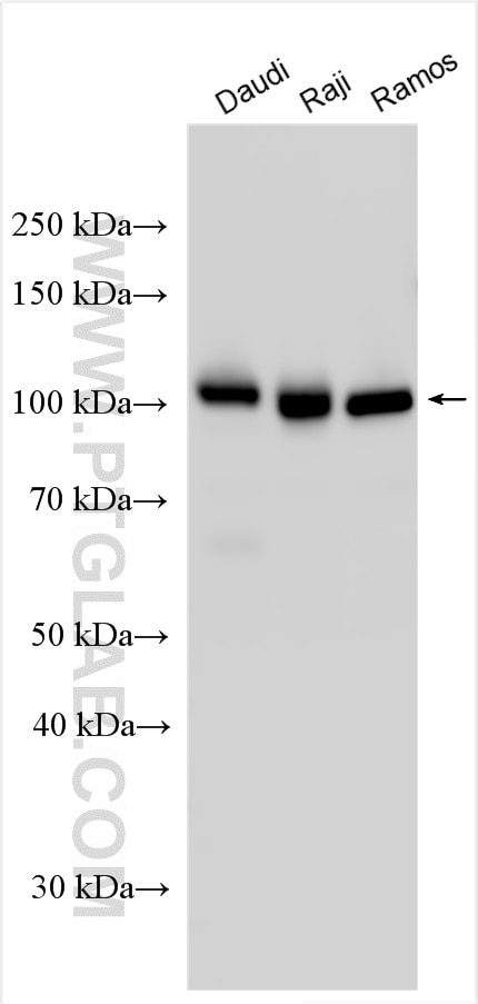 Western Blot (WB) analysis of various lysates using CD19 Polyclonal antibody (27914-1-AP)