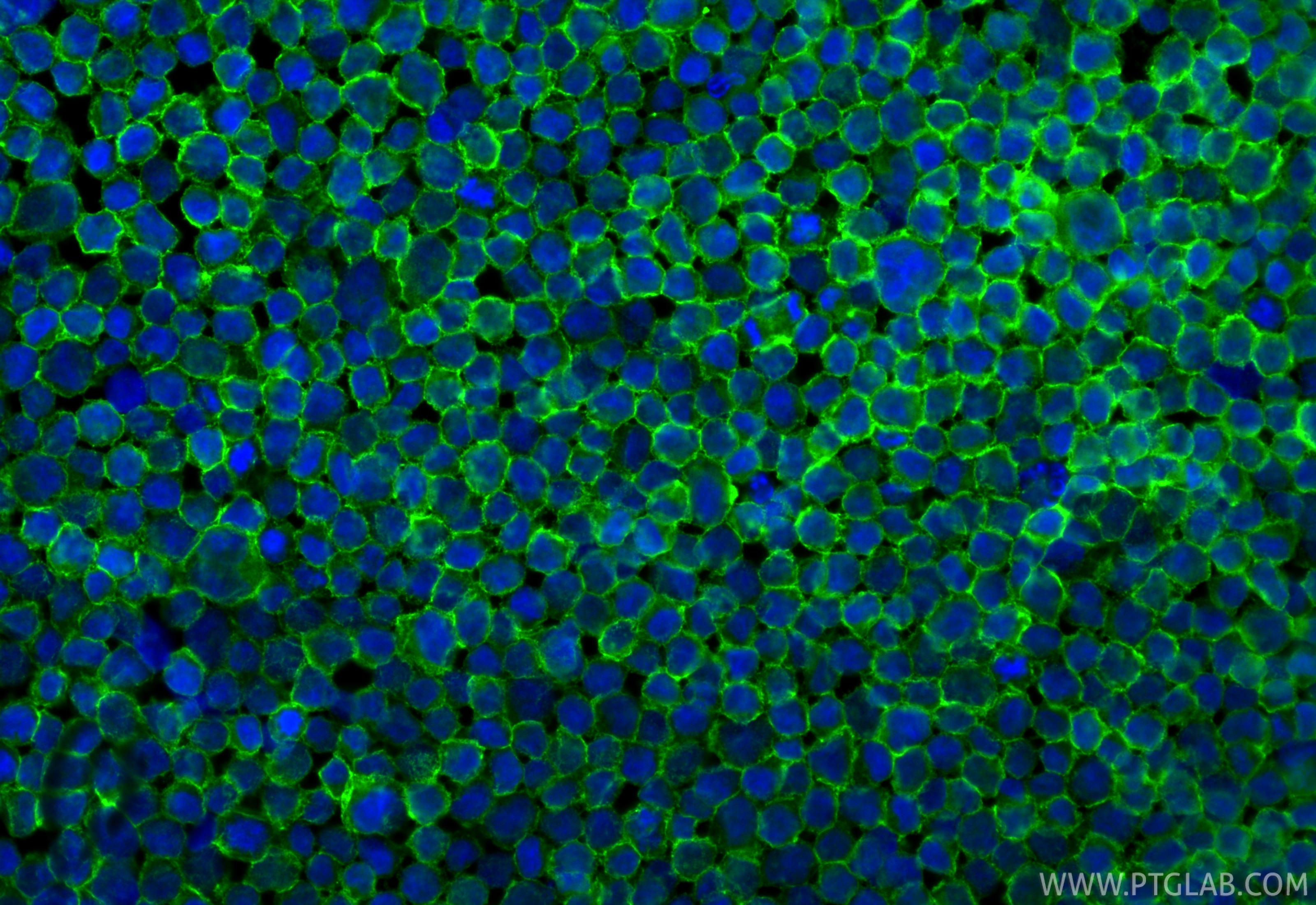 Immunofluorescence (IF) / fluorescent staining of Raji cells using CD19 Polyclonal antibody (27949-1-AP)
