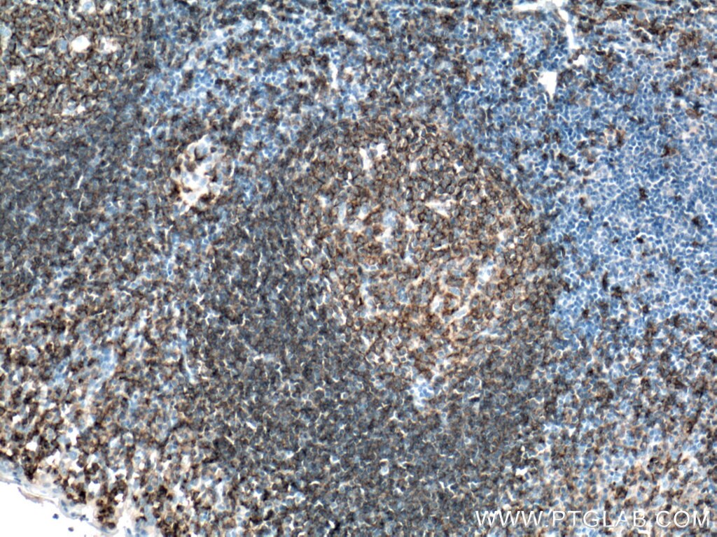 IHC staining of human tonsillitis using 27949-1-AP