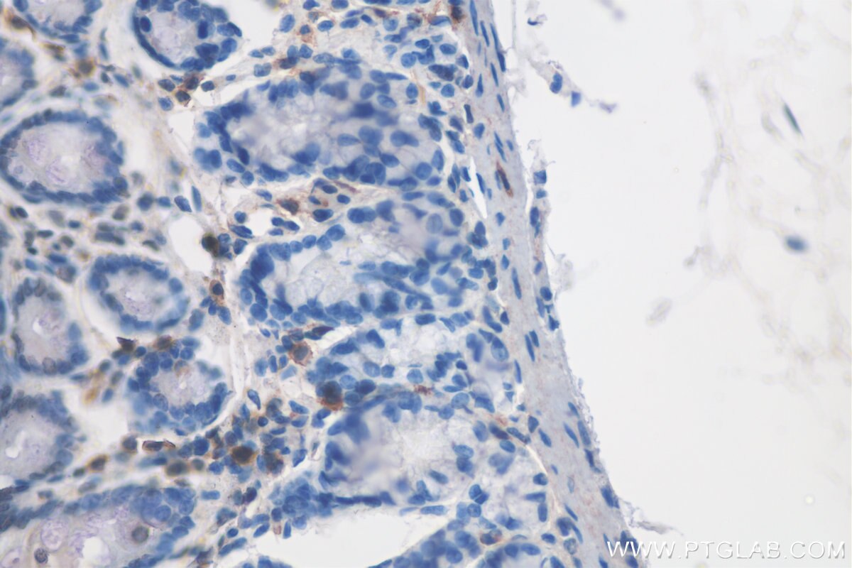 Immunohistochemistry (IHC) staining of rat colon tissue using CD19 Polyclonal antibody (27949-1-AP)