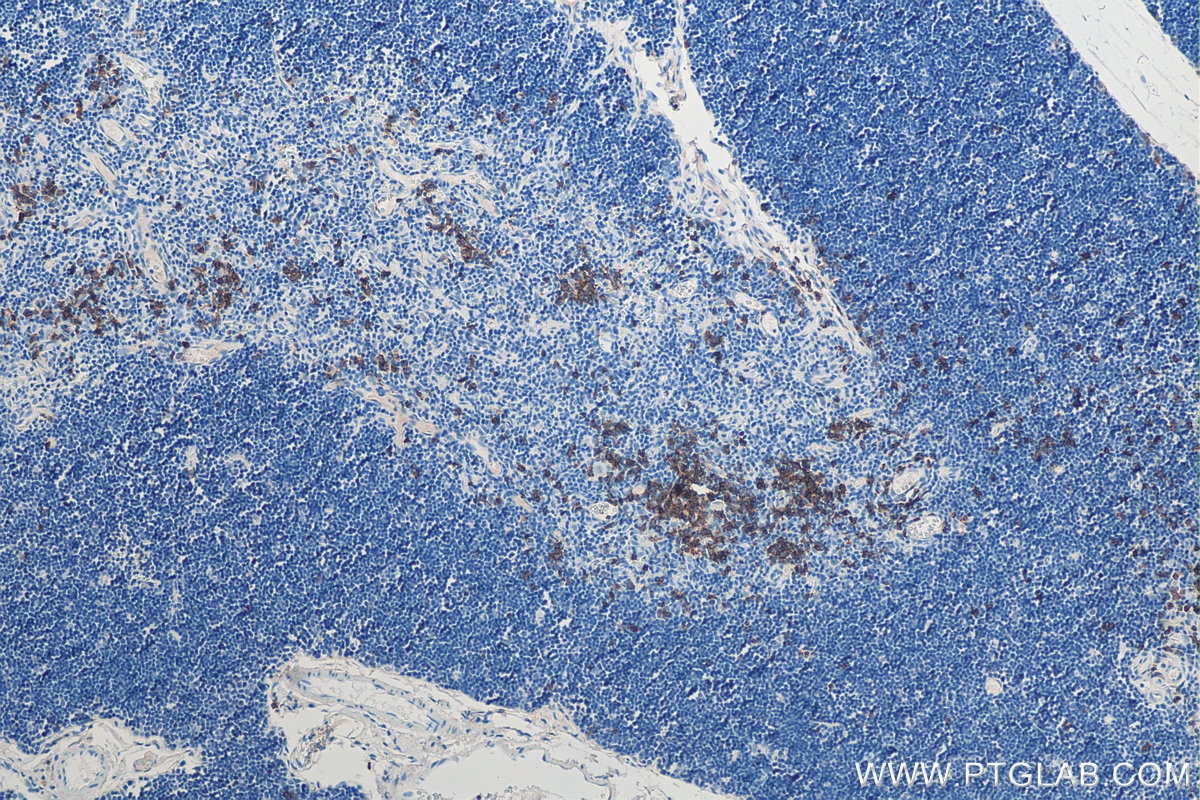 Immunohistochemistry (IHC) staining of rat thymus tissue using CD19 Polyclonal antibody (27949-1-AP)
