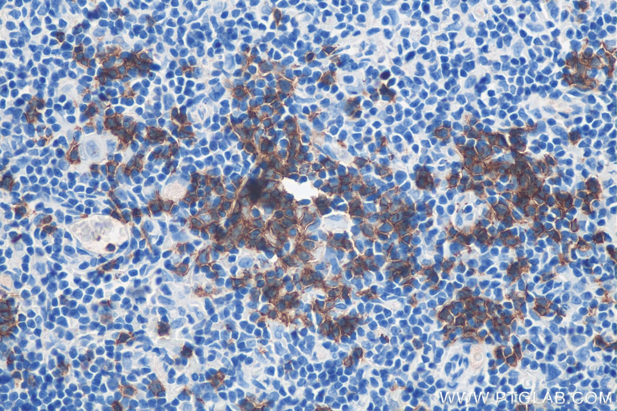 Immunohistochemistry (IHC) staining of rat thymus tissue using CD19 Polyclonal antibody (27949-1-AP)