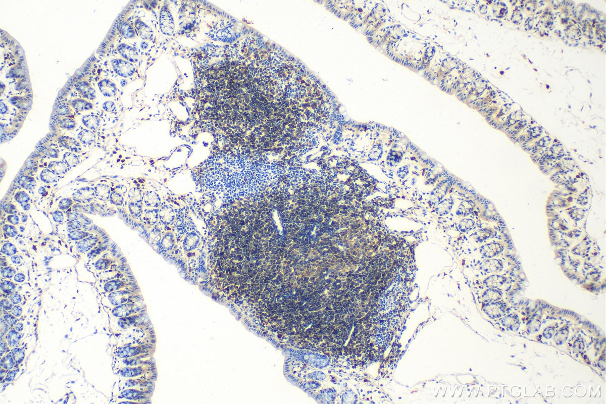Immunohistochemistry (IHC) staining of mouse colon tissue using CD19 Polyclonal antibody (27949-1-AP)