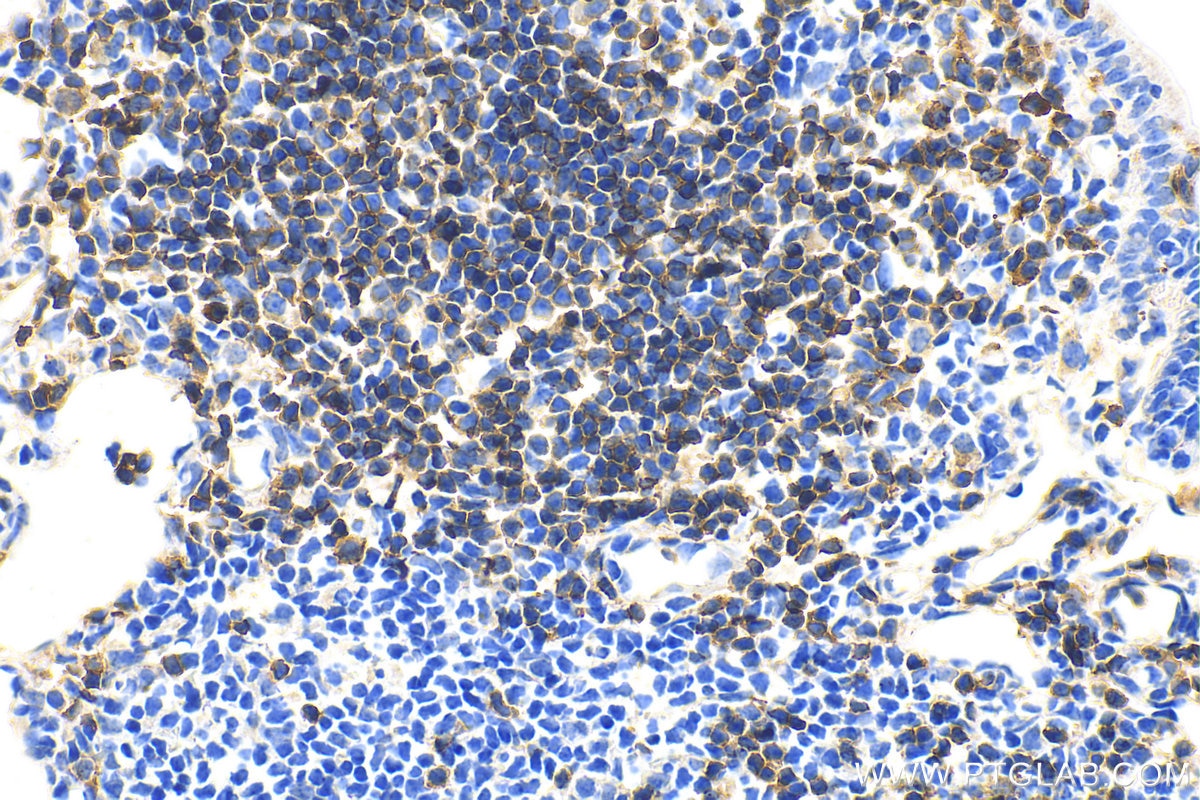 Immunohistochemistry (IHC) staining of mouse colon tissue using CD19 Polyclonal antibody (27949-1-AP)