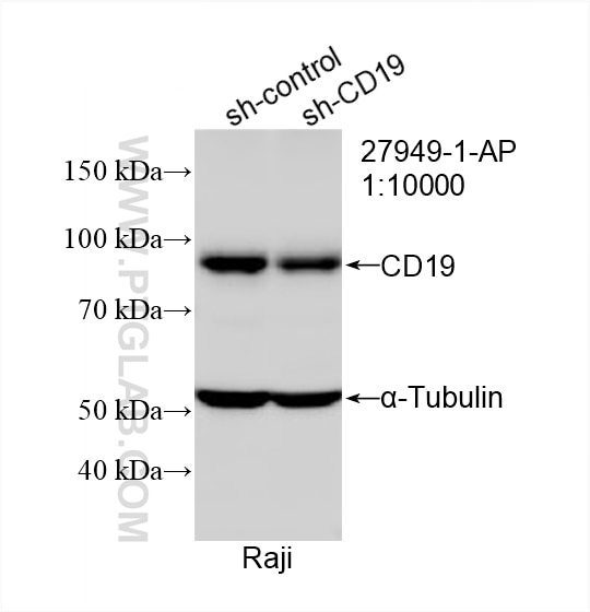 Western Blot (WB) analysis of Raji cells using CD19 Polyclonal antibody (27949-1-AP)