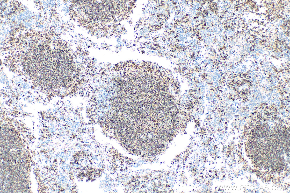 Immunohistochemistry (IHC) staining of mouse spleen tissue using CD19 Polyclonal antibody (31263-1-AP)
