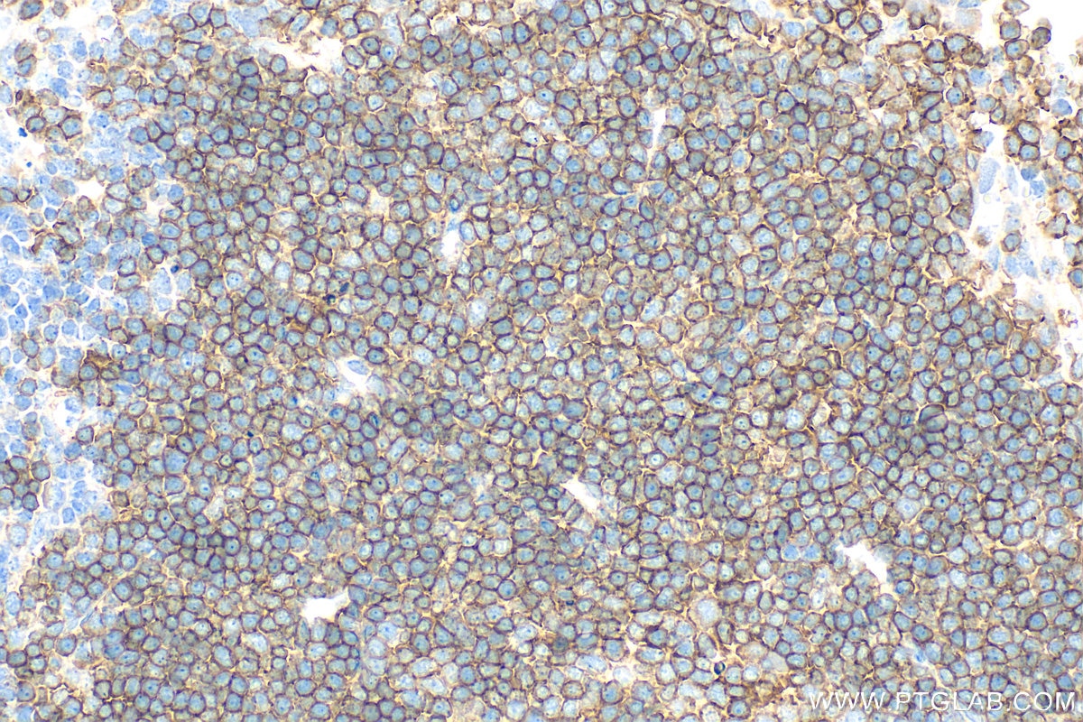 Immunohistochemistry (IHC) staining of mouse spleen tissue using CD19 Polyclonal antibody (31263-1-AP)