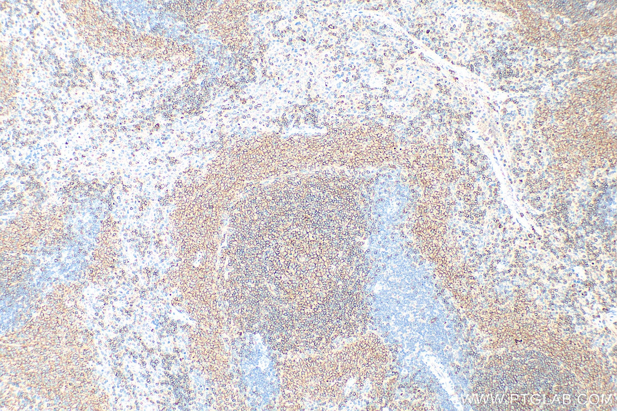 Immunohistochemistry (IHC) staining of rat spleen tissue using CD19 Polyclonal antibody (31263-1-AP)