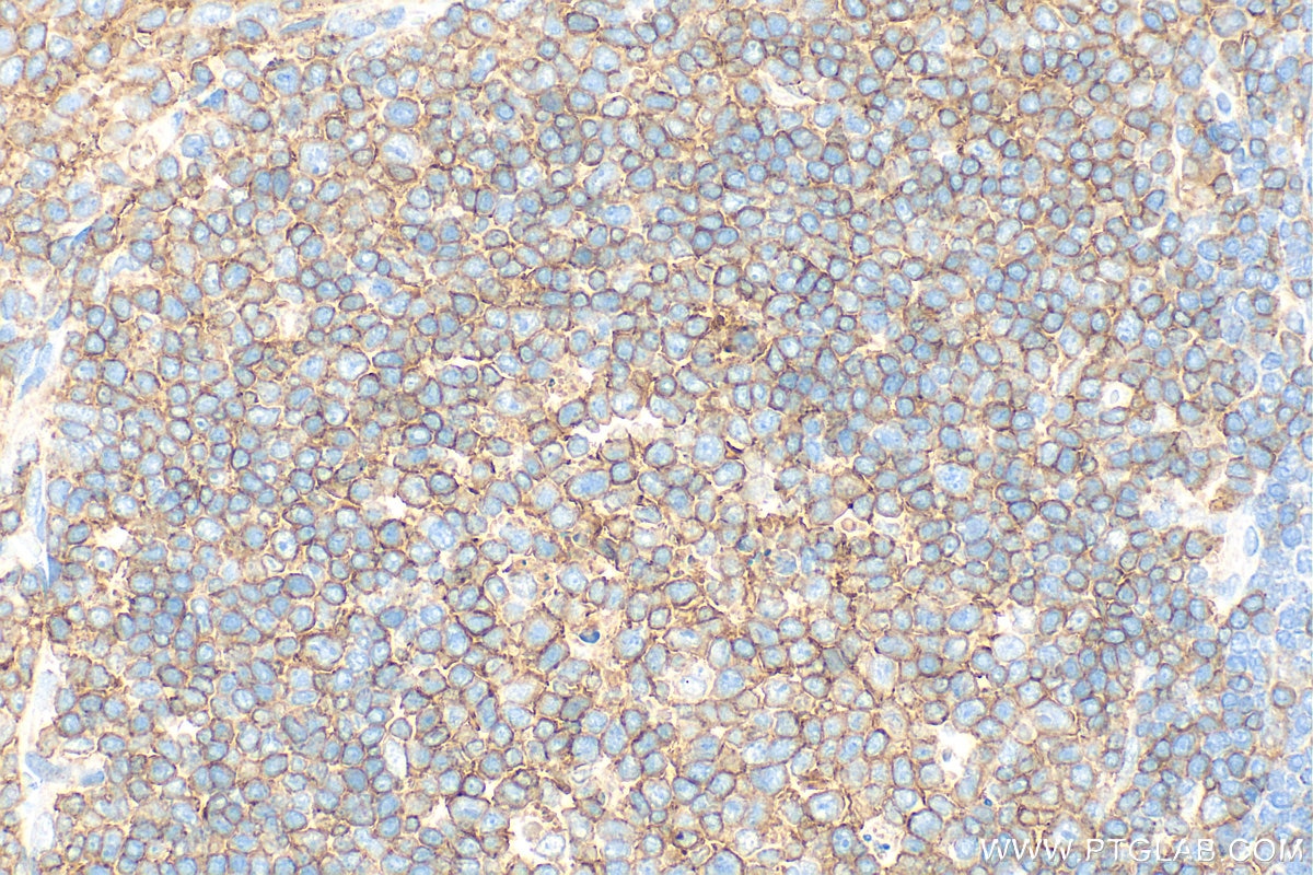 Immunohistochemistry (IHC) staining of rat spleen tissue using CD19 Polyclonal antibody (31263-1-AP)