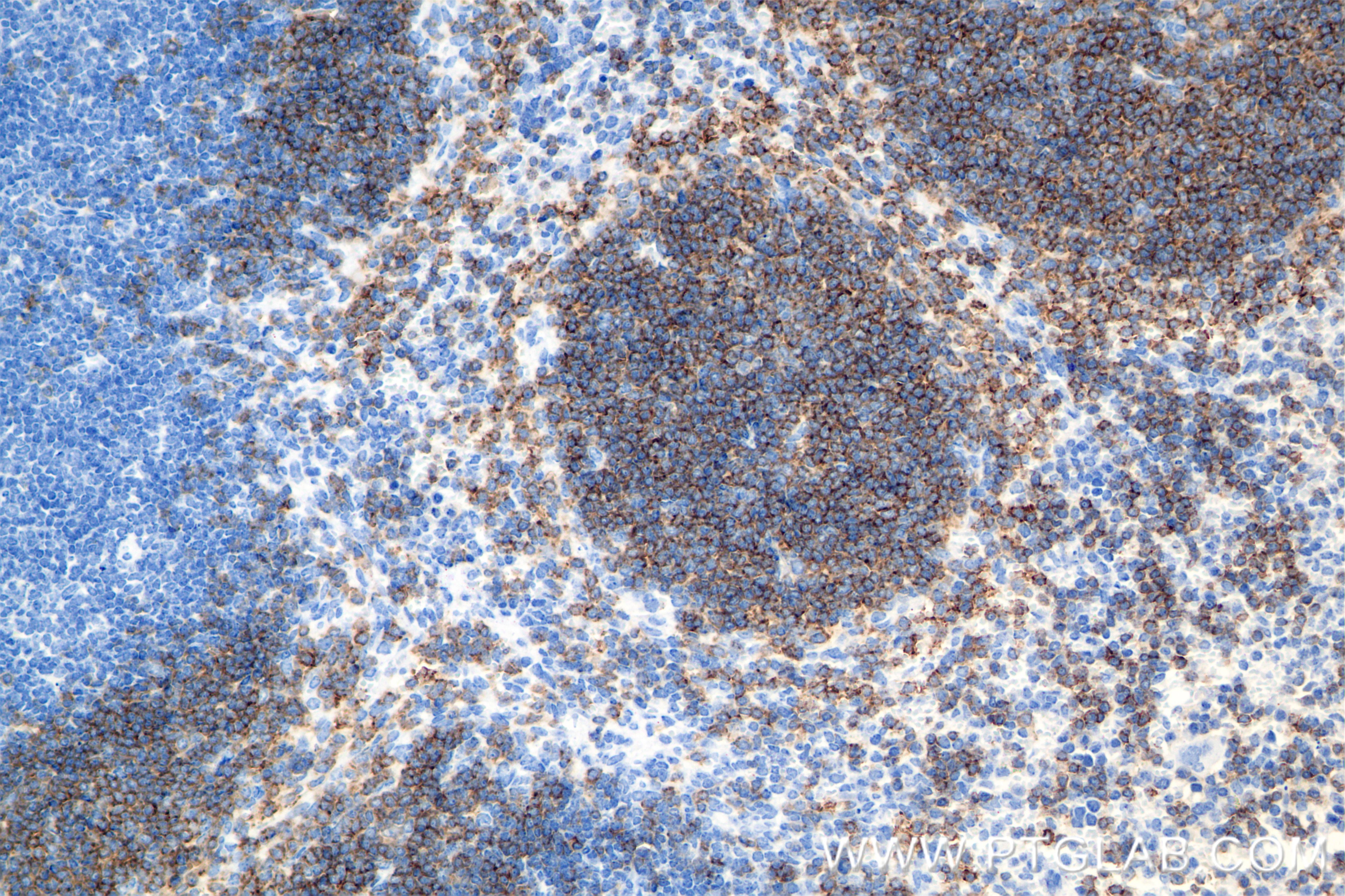 Immunohistochemistry (IHC) staining of mouse spleen tissue using CD19 Recombinant antibody (84848-5-RR)