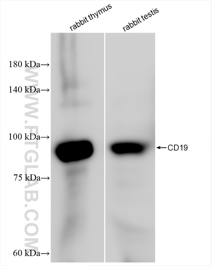 Western Blot (WB) analysis of various lysates using CD19 Recombinant antibody (85366-1-MR)