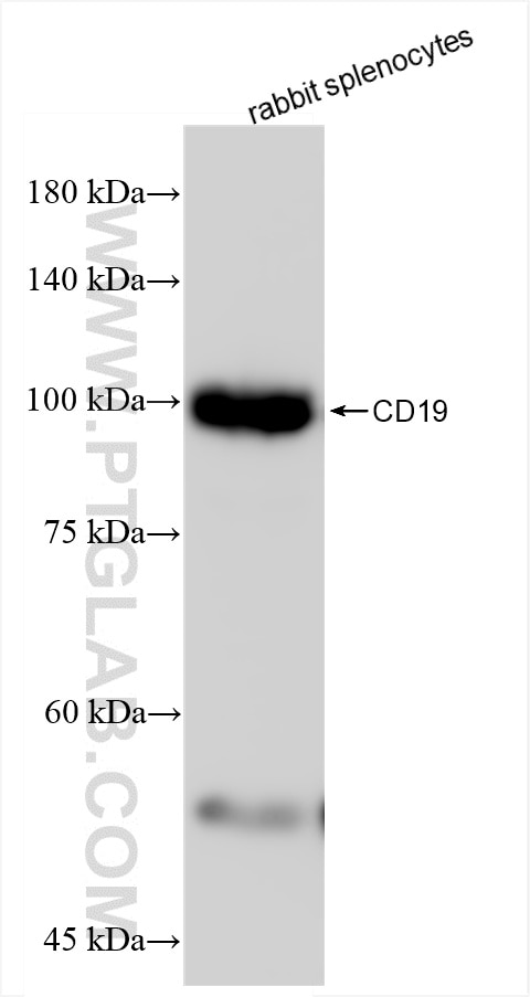 Western Blot (WB) analysis of various lysates using CD19 Recombinant antibody (85366-1-MR)