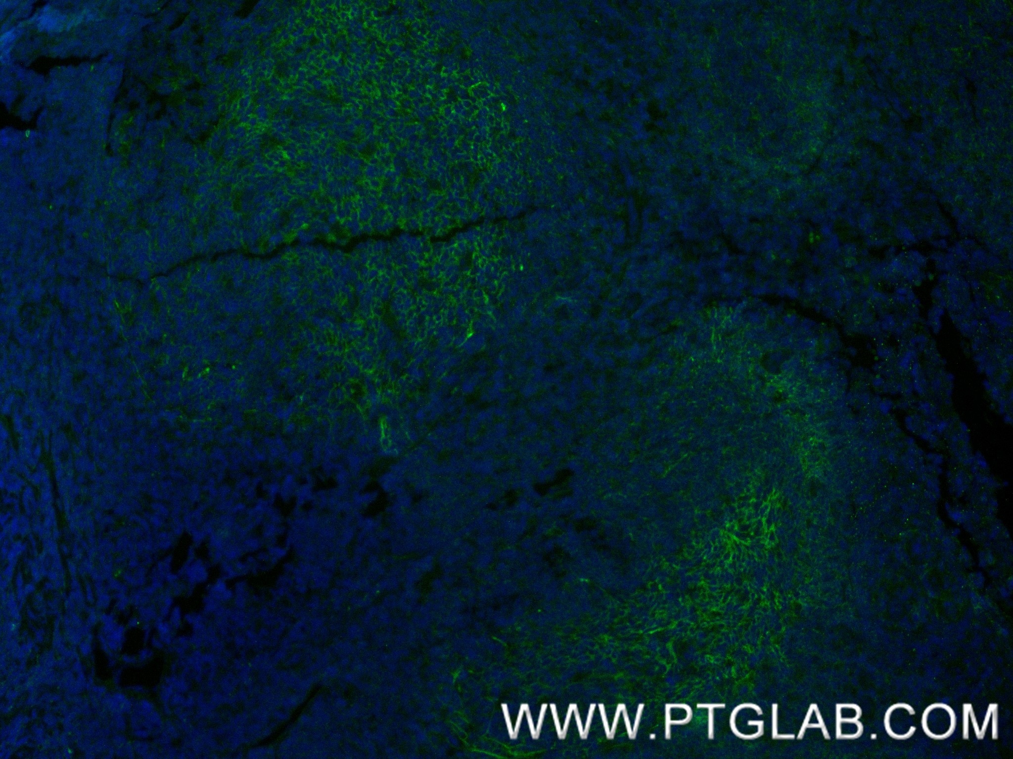 Immunofluorescence (IF) / fluorescent staining of human tonsillitis tissue using CD19 Recombinant antibody (86116-1-RR)