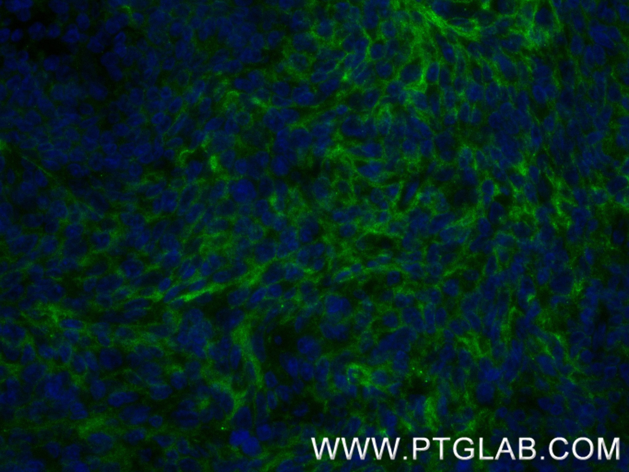 Immunofluorescence (IF) / fluorescent staining of human tonsillitis tissue using CD19 Recombinant antibody (86116-1-RR)