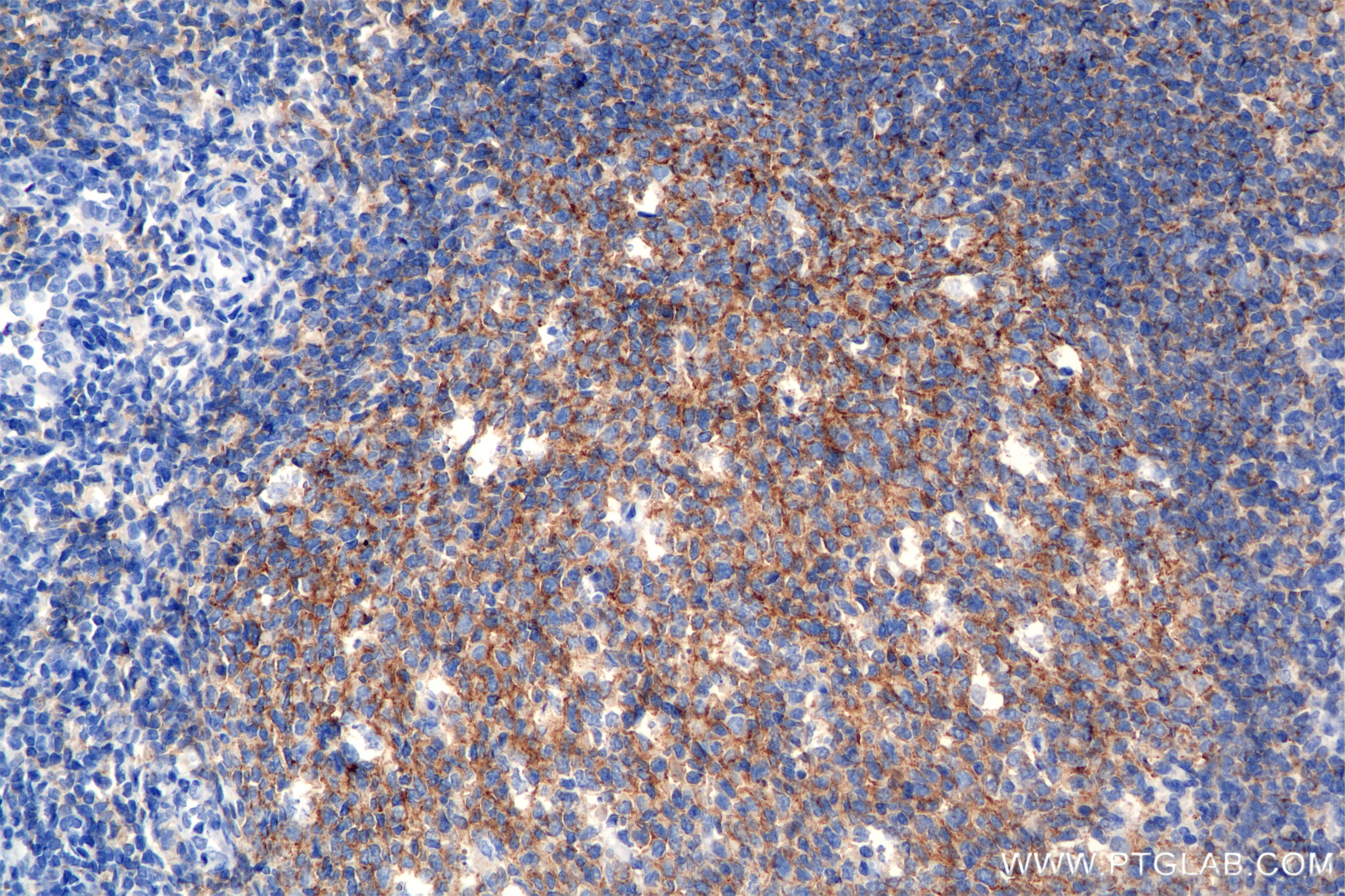Immunohistochemistry (IHC) staining of human tonsil tissue using CD19 Recombinant antibody (86116-1-RR)