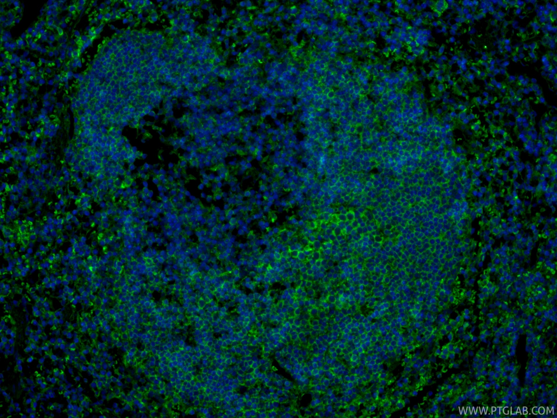 Immunofluorescent analysis of (4% PFA) fixed paraffin-embedded mouse spleen tissue using CoraLite® Plus 488 CD19 antibody (CL488-83254, Clone: 240135A3 ) at dilution of 1:200. Heat mediated antigen retrieval with Tris-EDTA buffer (pH 9.0). Immunofluorescence (IF) / fluorescent staining of mouse spleen tissue using CoraLite® Plus 488-conjugated CD19 Recombinant mon (CL488-83254)