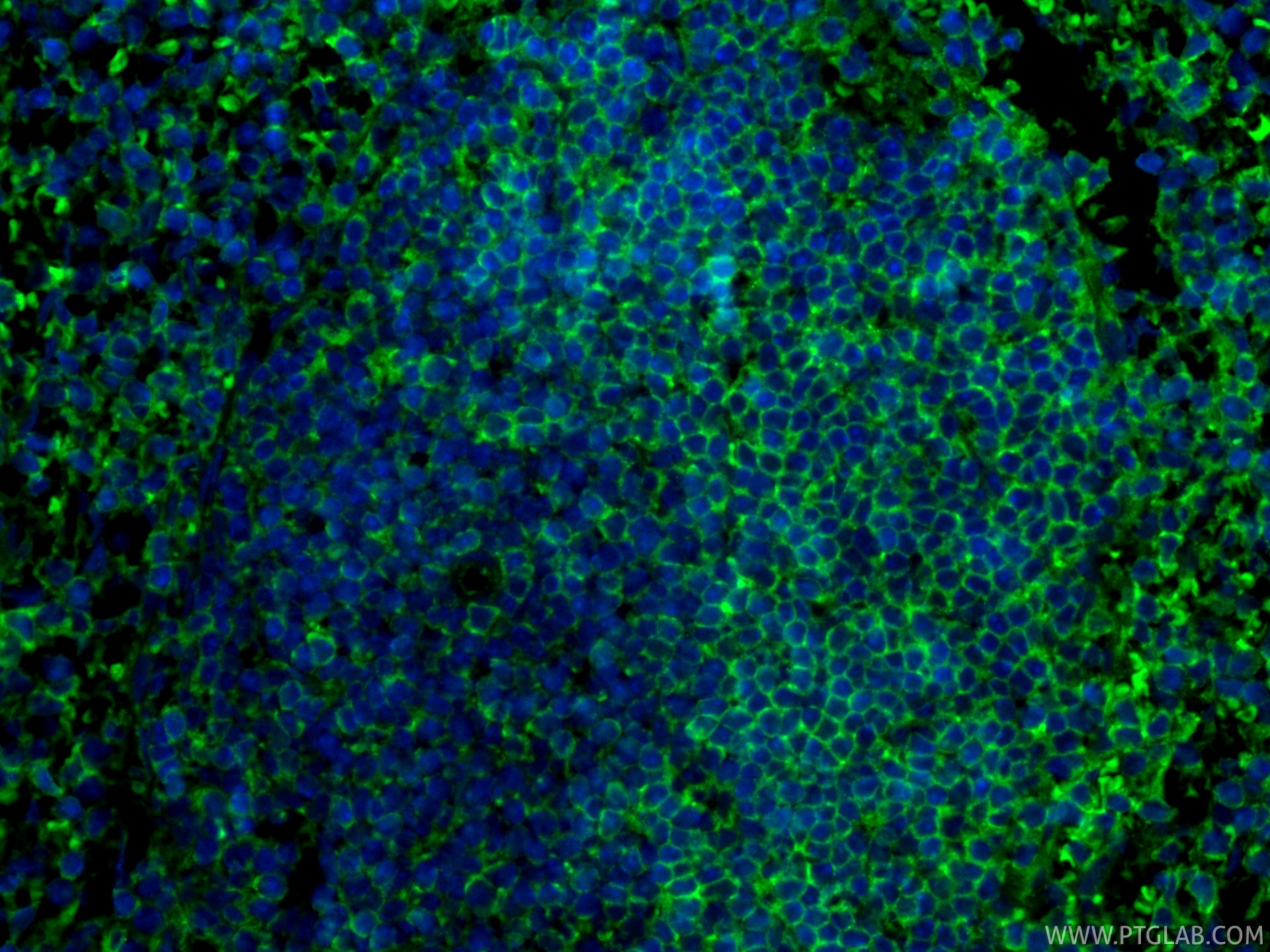 Immunofluorescent analysis of (4% PFA) fixed paraffin-embedded mouse spleen tissue using CoraLite® Plus 488 CD19 antibody (CL488-83254, Clone: 240135A3 ) at dilution of 1:200. Heat mediated antigen retrieval with Tris-EDTA buffer (pH 9.0). Immunofluorescence (IF) / fluorescent staining of mouse spleen tissue using CoraLite® Plus 488-conjugated CD19 Recombinant mon (CL488-83254)