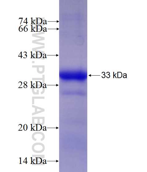 CD19 fusion protein Ag27404 SDS-PAGE
