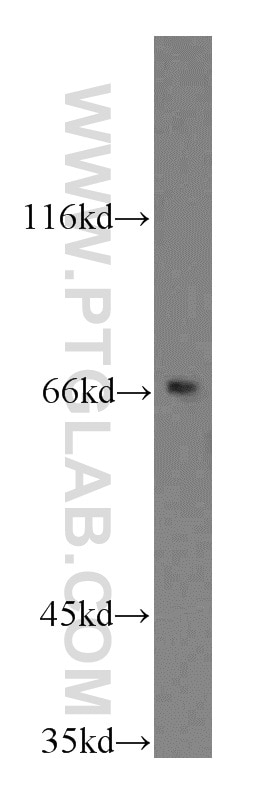 CD1a Polyclonal antibody