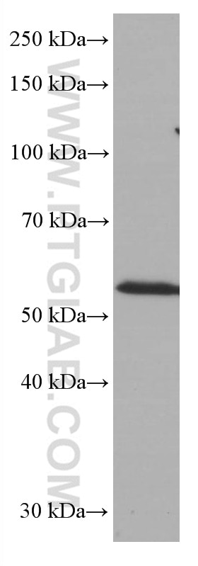 Western Blot (WB) analysis of Jurkat cells using CD1A Monoclonal antibody (60173-3-Ig)
