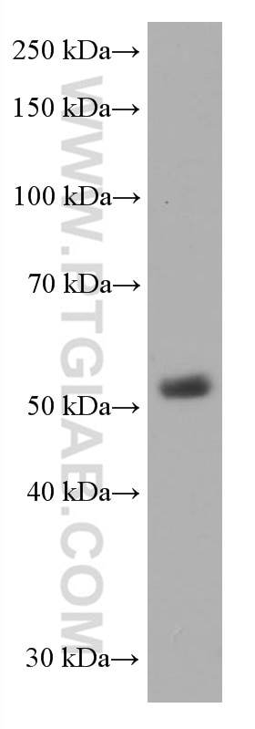 Western Blot (WB) analysis of pig thymus tissue using CD1A Monoclonal antibody (60173-3-Ig)