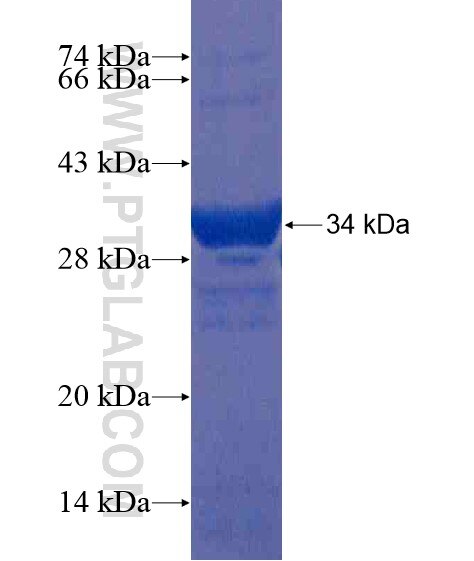 CD1A fusion protein Ag20854 SDS-PAGE