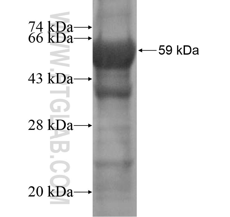 CD1A fusion protein Ag11304 SDS-PAGE