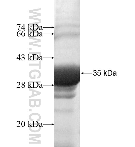 CD1A fusion protein Ag11334 SDS-PAGE