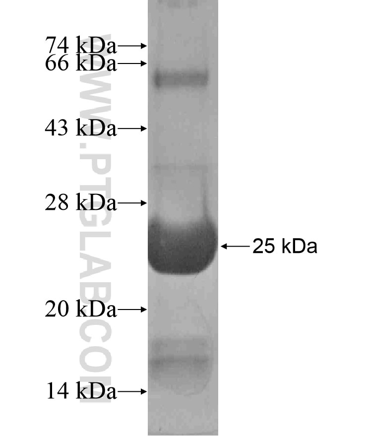 CD1A fusion protein Ag17442 SDS-PAGE