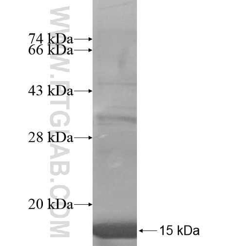CD1B fusion protein Ag15400 SDS-PAGE