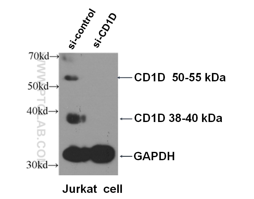 Western Blot (WB) analysis of Jurkat cells using CD1d Polyclonal antibody (17336-1-AP)