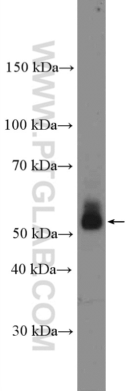Western Blot (WB) analysis of mouse skin tissue using CD1d Polyclonal antibody (17336-1-AP)
