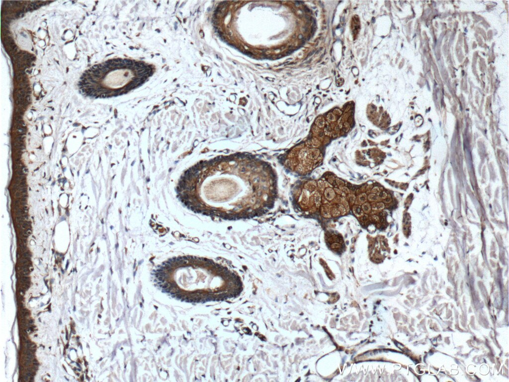 Immunohistochemistry (IHC) staining of human skin tissue using CD1d Monoclonal antibody (66257-1-Ig)