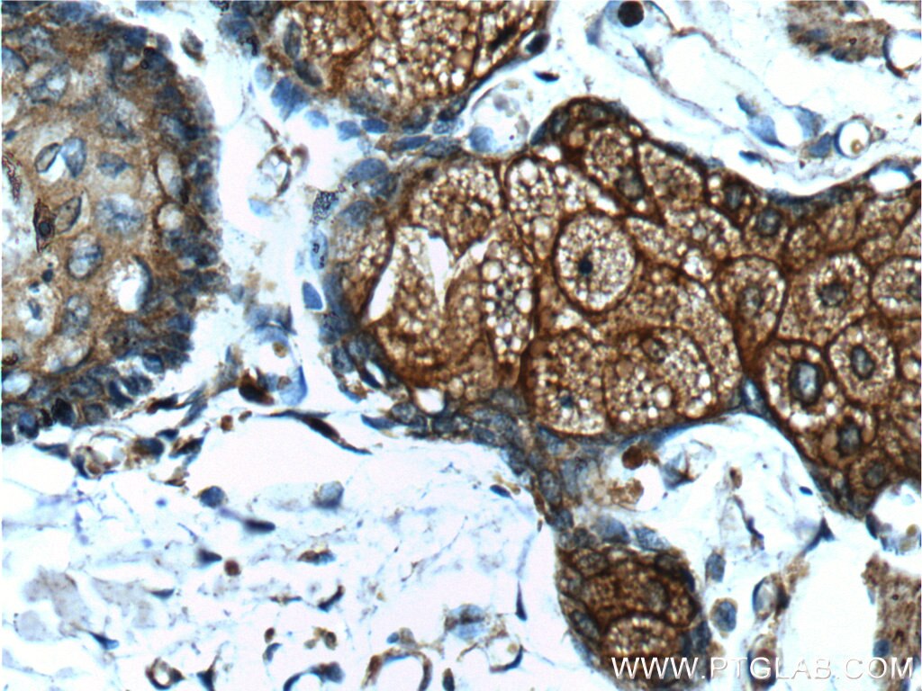 Immunohistochemistry (IHC) staining of human skin tissue using CD1d Monoclonal antibody (66257-1-Ig)