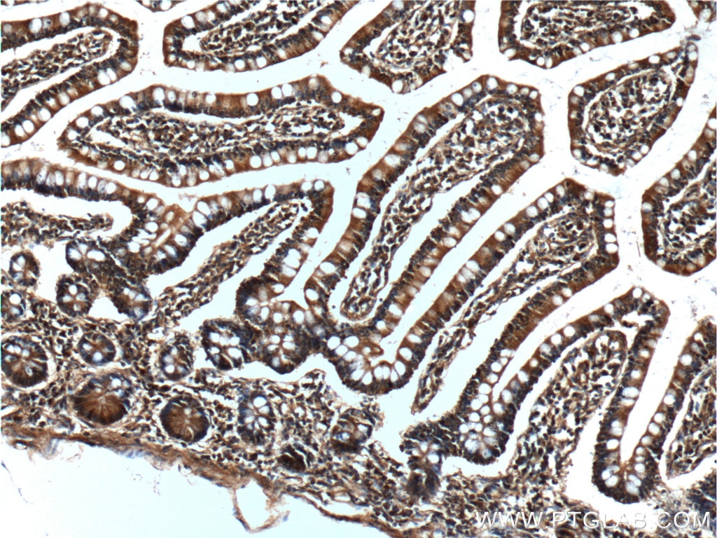 Immunohistochemistry (IHC) staining of human small intestine tissue using CD1d Monoclonal antibody (66257-1-Ig)