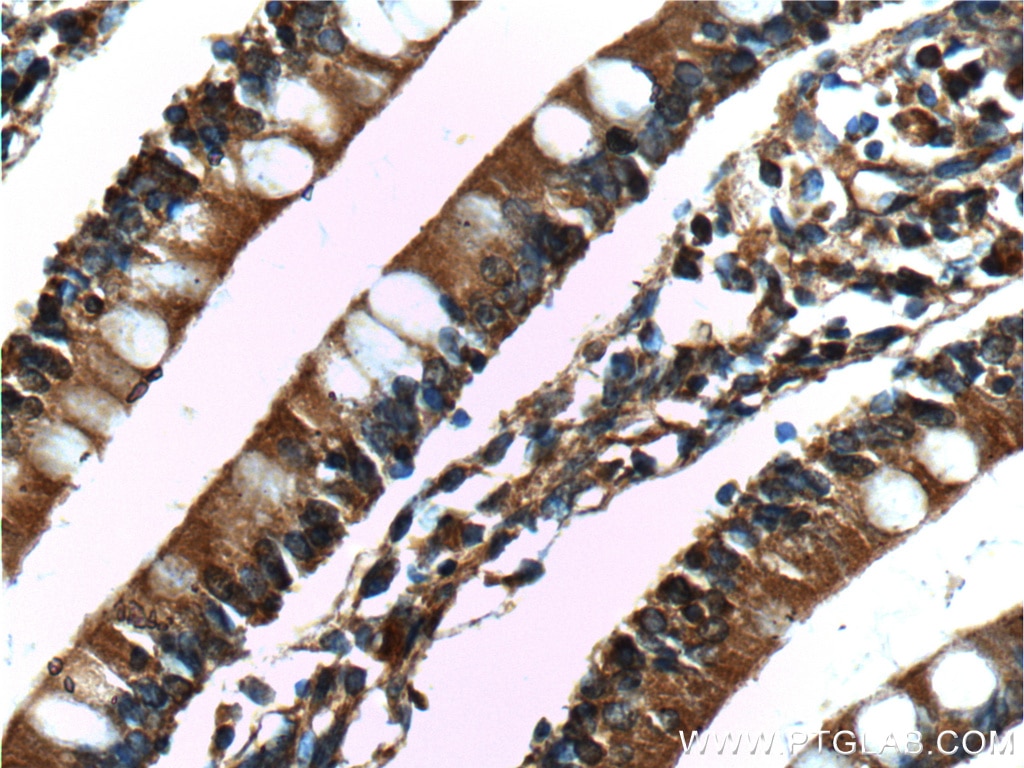 Immunohistochemistry (IHC) staining of human small intestine tissue using CD1d Monoclonal antibody (66257-1-Ig)