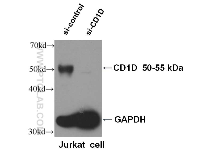 Western Blot (WB) analysis of Jurkat cells using CD1d Monoclonal antibody (66257-1-Ig)