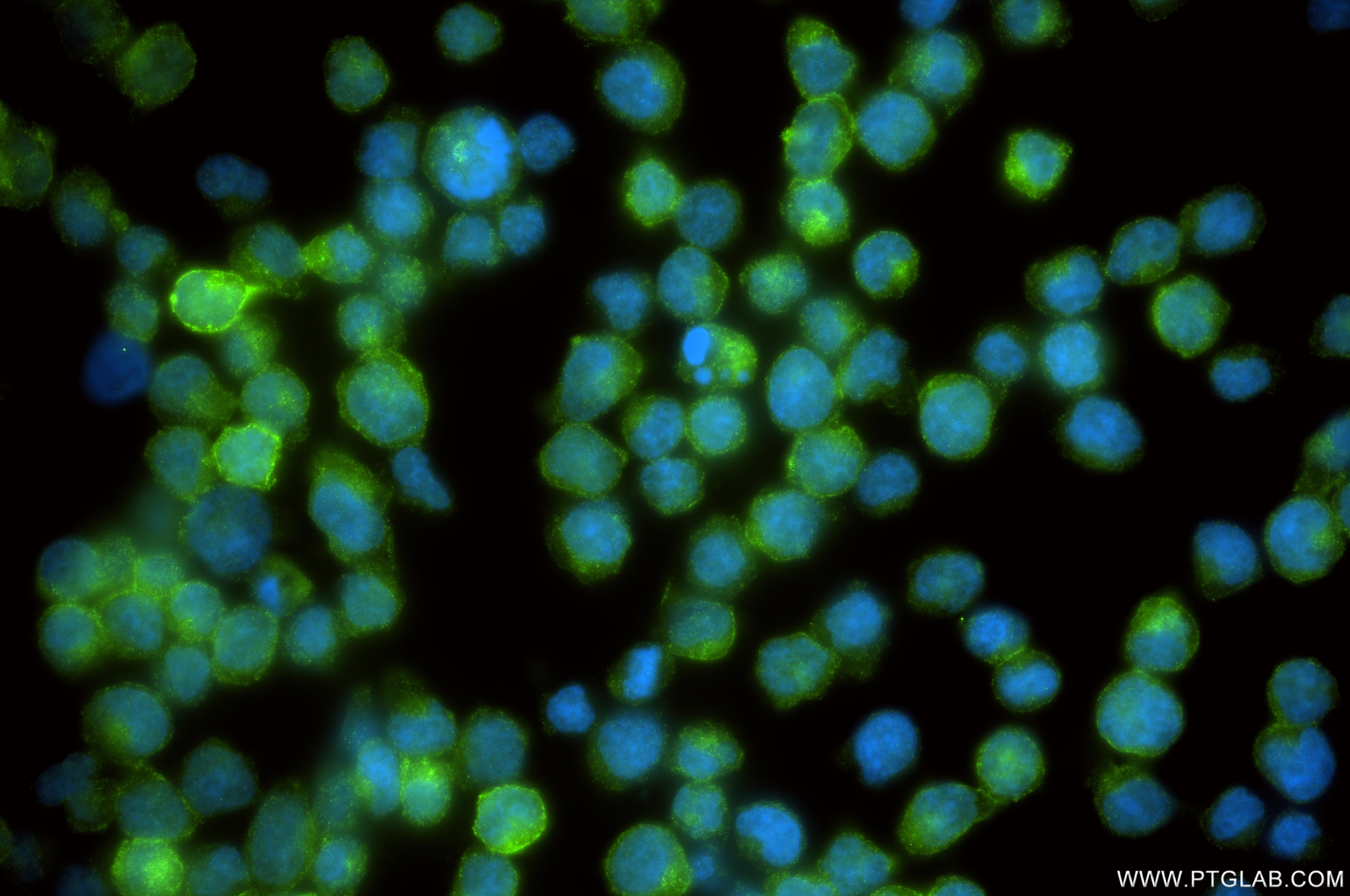 IF Staining of Jurkat using 87145-2-RR Immunofluorescence (IF) / fluorescent staining of Jurkat cells using CD1c Recombinant monoclonal antibody (87145-2-RR)