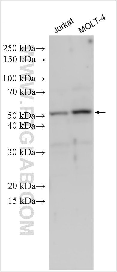 Western Blot (WB) analysis of various lysates using CD1e Polyclonal antibody (22463-1-AP)