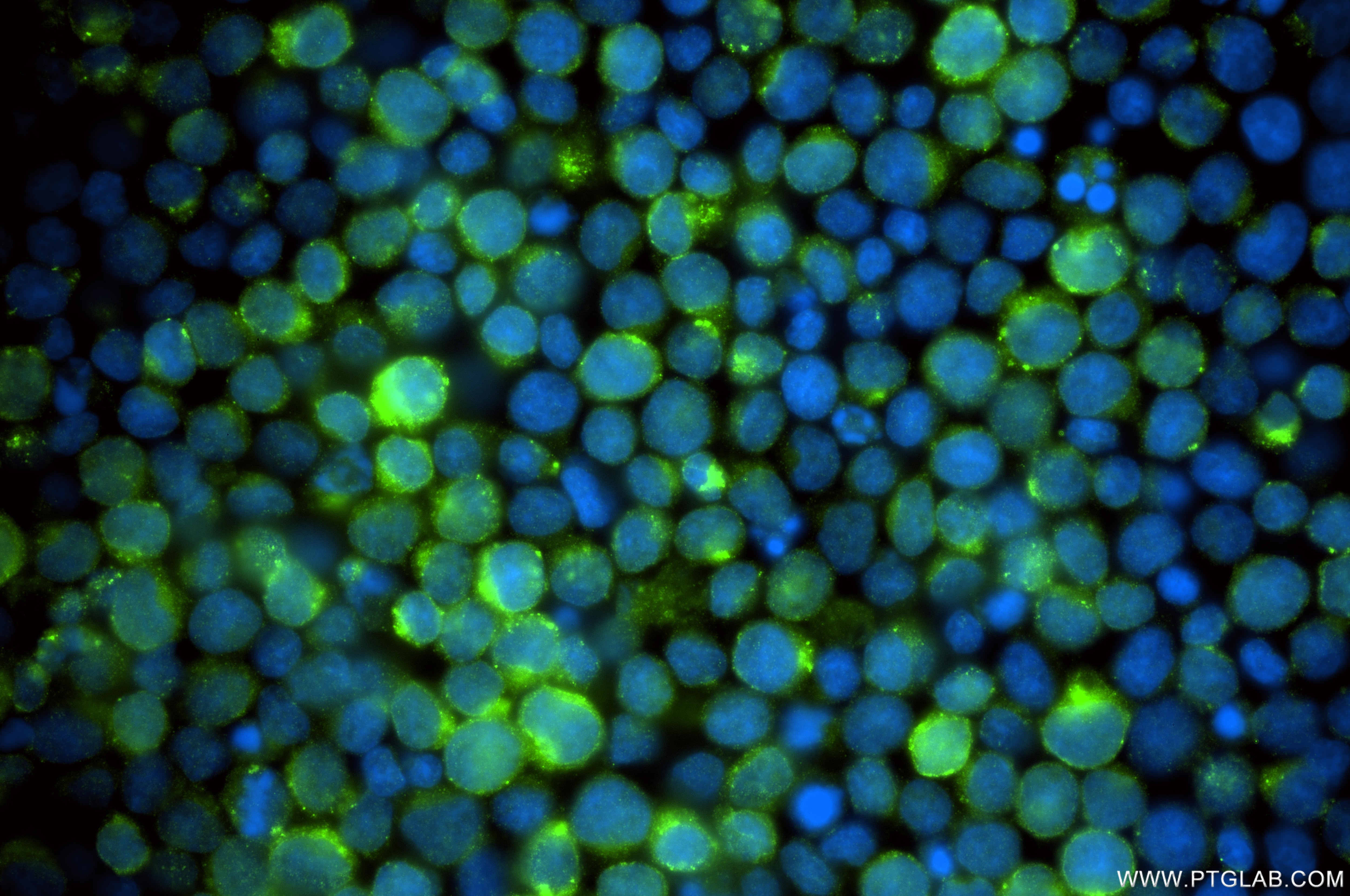 Immunofluorescence (IF) / fluorescent staining of Jurkat cells using CD1e Recombinant monoclonal antibody (87398-1-RR)