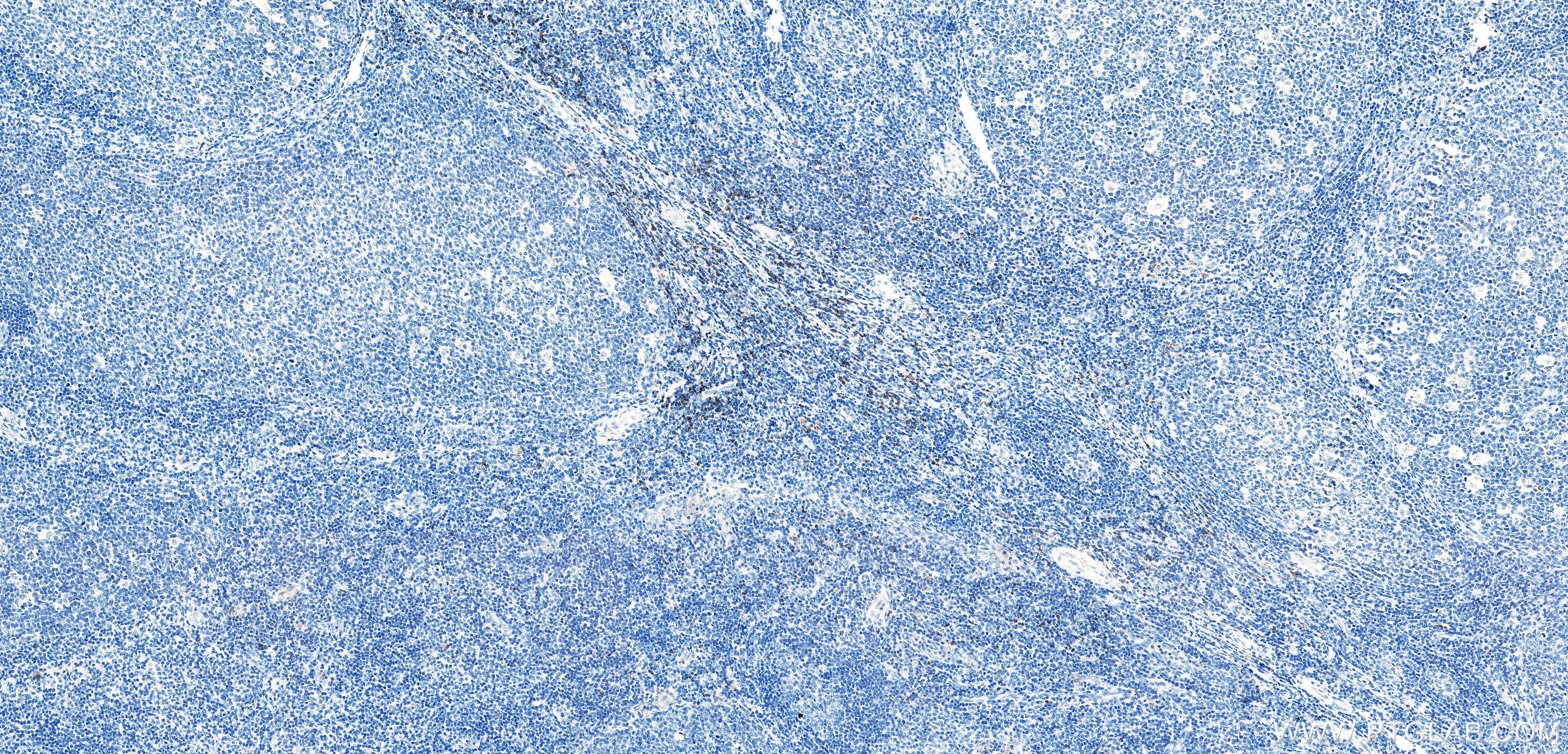 IHC staining of human tonsil using 87398-1-RR (same clone as 87398-1-PBS) Immunohistochemistry (IHC) staining of human tonsil tissue using CD1e Recombinant monoclonal antibody (87398-1-RR)