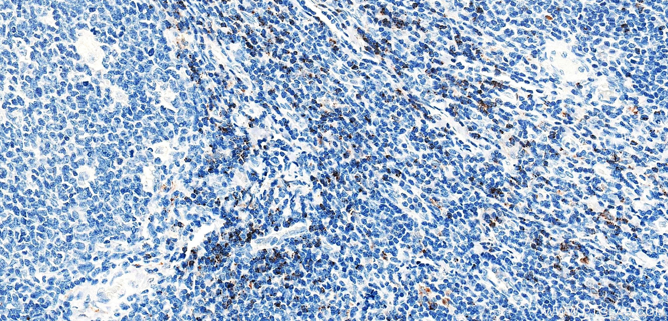 IHC staining of human tonsil using 87398-1-RR (same clone as 87398-1-PBS) Immunohistochemistry (IHC) staining of human tonsil tissue using CD1e Recombinant monoclonal antibody (87398-1-RR)