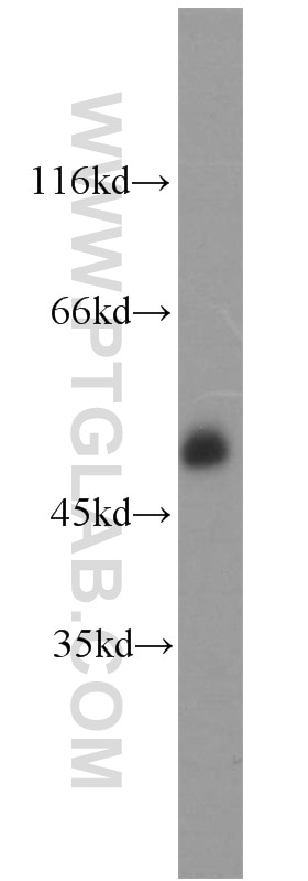 Western Blot (WB) analysis of Jurkat cells using CD2 Polyclonal antibody (10299-1-AP)