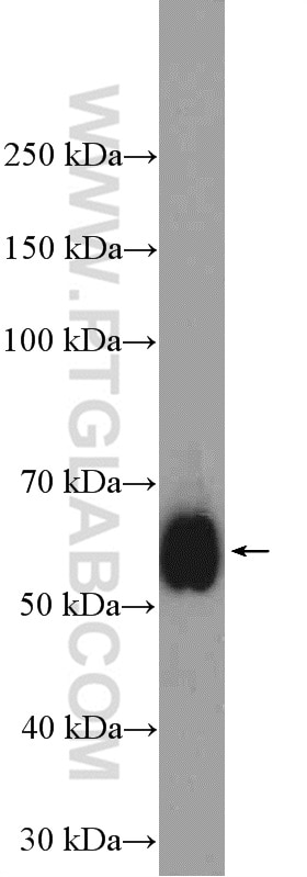 Western Blot (WB) analysis of Jurkat cells using CD2 Polyclonal antibody (23973-1-AP)