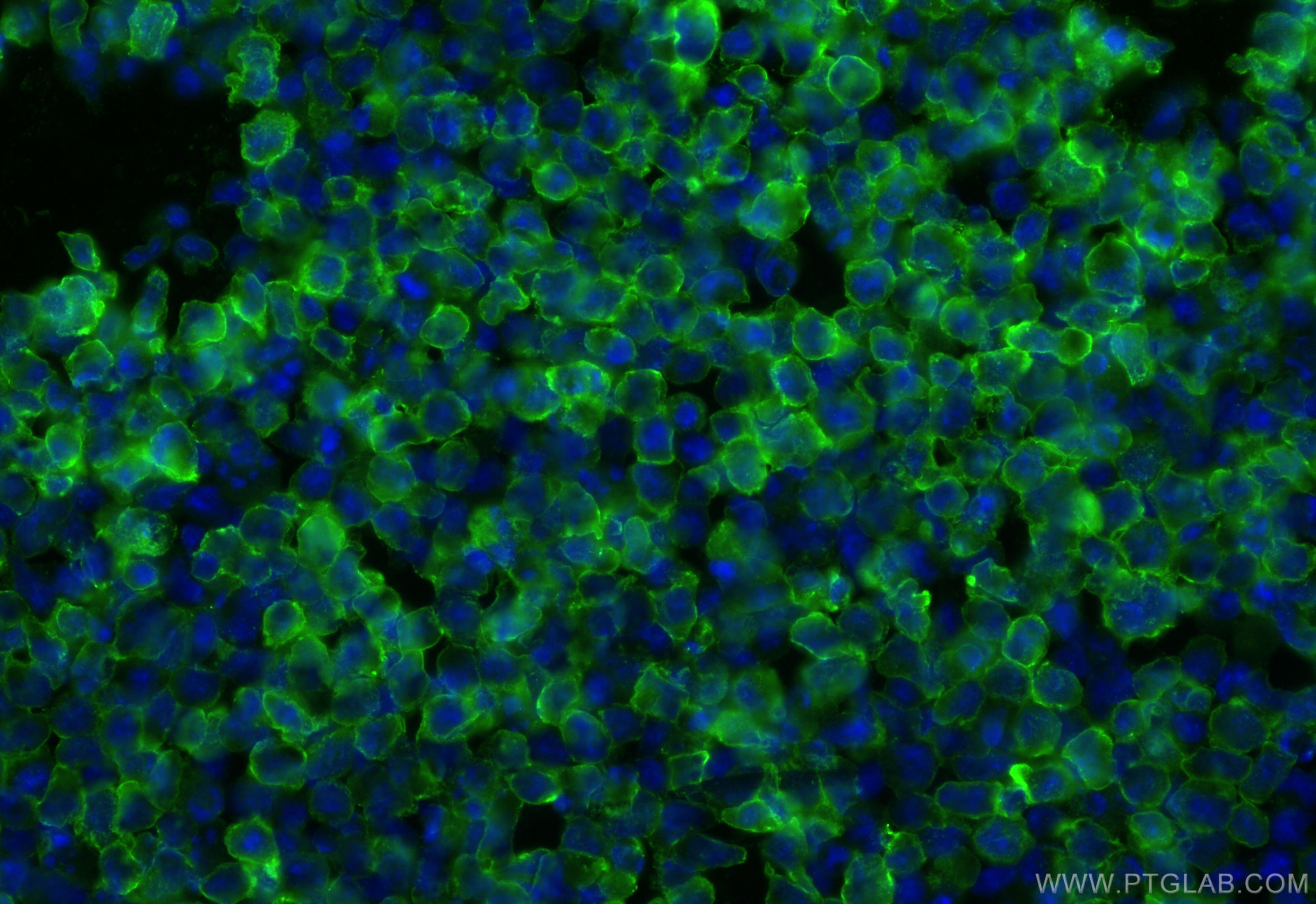 Immunofluorescence (IF) / fluorescent staining of EL-4 cells using CD2 Polyclonal antibody (31947-1-AP)