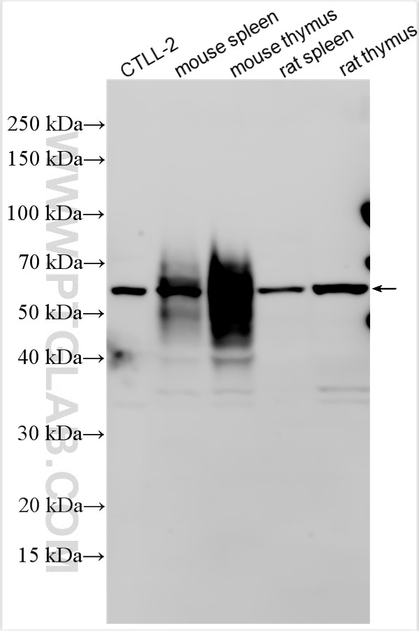 Western Blot (WB) analysis of various lysates using CD2 Polyclonal antibody (31947-1-AP)