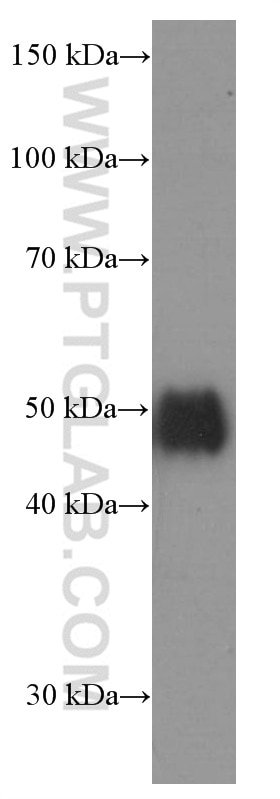 Western Blot (WB) analysis of Jurkat cells using CD2 Monoclonal antibody (60005-1-Ig)