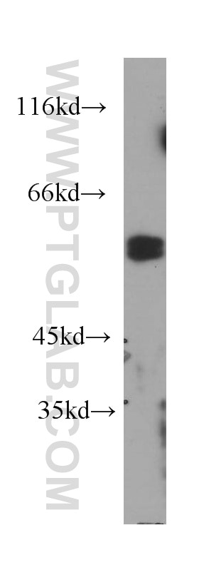 CD2 Monoclonal antibody