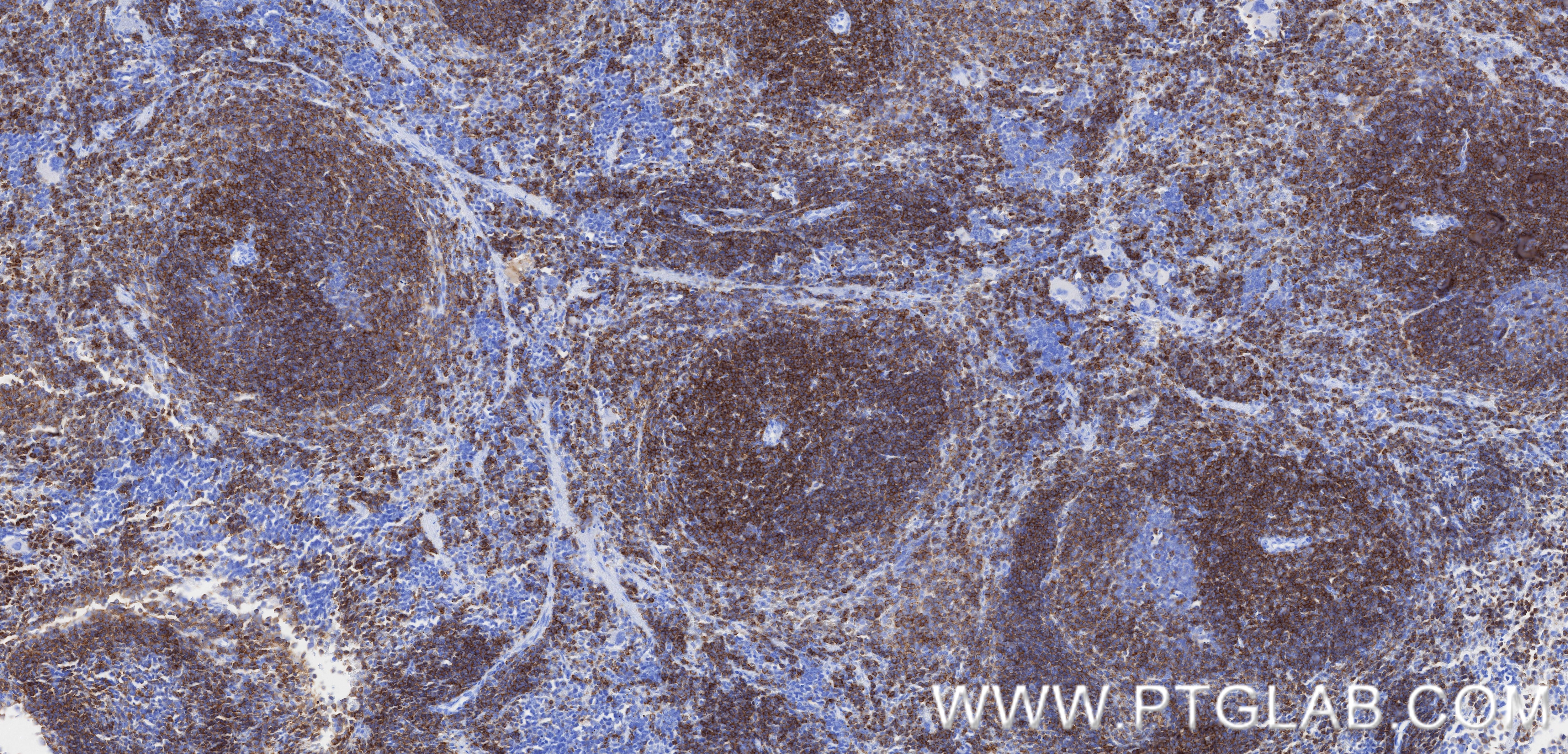 Immunohistochemistry (IHC) staining of mouse spleen tissue using CD2 Recombinant monoclonal antibody (84360-4-RR)